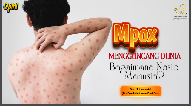 Mpox mengguncang dunia, bagaimana nasib manusia?