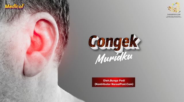 Congek Muridku